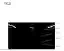Fig. 04 - Anterior ocular segment optical coherence tomographic imaging device and anterior ocular segment optical coherence tomographic imaging method