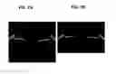Fig. 08 - Anterior ocular segment optical coherence tomographic imaging device and anterior ocular segment optical coherence tomographic imaging method