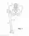 Fig. 02 - SYSTEMS AND METHODS FOR MEASURING RELATIVE ORIENTATION AND POSITION OF ADJACENT BONES