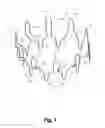 Fig. 02 - BILLOWING GRAFT ASSEMBLIES FORMED FORM ONE OR MORE ADVANTAGEOUSLY SELECTED STRUCTURAL FEATURES