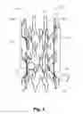 Fig. 05 - BILLOWING GRAFT ASSEMBLIES FORMED FORM ONE OR MORE ADVANTAGEOUSLY SELECTED STRUCTURAL FEATURES