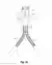 Fig. 26 - BILLOWING GRAFT ASSEMBLIES FORMED FORM ONE OR MORE ADVANTAGEOUSLY SELECTED STRUCTURAL FEATURES