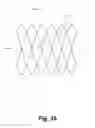 Fig. 32 - BILLOWING GRAFT ASSEMBLIES FORMED FORM ONE OR MORE ADVANTAGEOUSLY SELECTED STRUCTURAL FEATURES