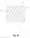 Fig. 34 - BILLOWING GRAFT ASSEMBLIES FORMED FORM ONE OR MORE ADVANTAGEOUSLY SELECTED STRUCTURAL FEATURES