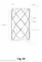 Fig. 35 - BILLOWING GRAFT ASSEMBLIES FORMED FORM ONE OR MORE ADVANTAGEOUSLY SELECTED STRUCTURAL FEATURES
