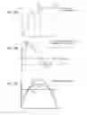 Fig. 15 - Temporal and spatial video noise reduction