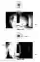 Fig. 19 - Using a depth map of a monitored scene to identify floors, walls, and ceilings
