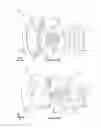 Fig. 07 - Detachable audio system for head-mounted displays