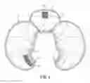 Fig. 03 - Hair Dryer Shield
