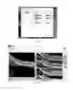 Fig. 05 - User interface for acquisition, display and analysis of ophthalmic diagnostic data