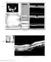 Fig. 07 - User interface for acquisition, display and analysis of ophthalmic diagnostic data