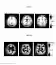 Fig. 08 - Apparatus and method for electrical properties tomography using magnetic resonance
