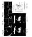 Fig. 06 - Phase measurement, analysis, and correction methods for coherent imaging systems