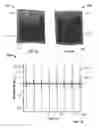 Fig. 07 - Wearable graphene sensors
