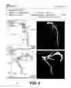 Fig. 05 - Systems and methods for reporting blood flow characteristics
