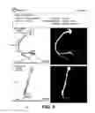 Fig. 06 - Systems and methods for reporting blood flow characteristics