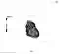 Fig. 07 - Method and system for evaluation of functional cardiac electrophysiology