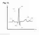 Fig. 08 - Remote interfacing of extended wear electrocardiography and physiological sensor monitor