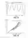 Fig. 09 - DEVICES AND METHODS FOR NON-INVASIVE VENTILATION THERAPY