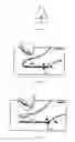 Fig. 06 - Sensor systems for user-specific evaluation of gait, footwear and garment fitting; monitoring of contact, force, pressure and/or shear at or near body surfaces