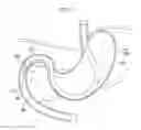 Fig. 09 - Puncture needle for endoscope