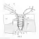 Fig. 06 - Anti-backup suture anchor