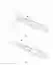 Fig. 03 - Hemostatic clip