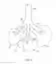 Fig. 04 - Collateral flow channel sealant delivery methods and systems