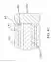 Fig. 10 - Tourniquet and Windlass Assembly and Method