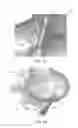 Fig. 06 - Adaptive surface surgical guiding apparatuses including stability and/or verification elements
