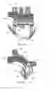 Fig. 07 - Adaptive surface surgical guiding apparatuses including stability and/or verification elements