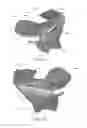 Fig. 08 - Adaptive surface surgical guiding apparatuses including stability and/or verification elements