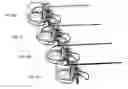 Fig. 07 - Methods, systems, and devices for diagnosing and treating intervertebral disc degeneration