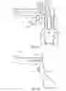 Fig. 07 - Tibial cut guide