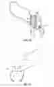 Fig. 09 - Tibial cut guide
