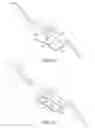 Fig. 15 - Tibial cut guide