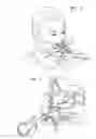 Fig. 02 - Nosebleed-attenuating apparatus