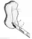 Fig. 01 - Pediatric combination surgical device