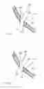 Fig. 12 - APPARATUS AND METHOD FOR ACCESSING A SINUS CAVITY