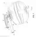 Fig. 02 - Cervical cerclage assistance device