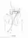 Fig. 09 - Cervical cerclage assistance device
