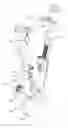 Fig. 01 - Reduction jack for spinal rod placement and method of use