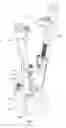 Fig. 02 - Reduction jack for spinal rod placement and method of use