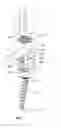 Fig. 03 - Reduction jack for spinal rod placement and method of use