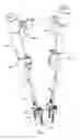 Fig. 04 - Reduction jack for spinal rod placement and method of use