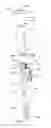 Fig. 05 - Reduction jack for spinal rod placement and method of use