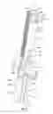 Fig. 06 - Reduction jack for spinal rod placement and method of use