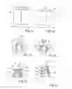 Fig. 02 - Implant, implantation device, implantation method