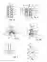 Fig. 03 - Implant, implantation device, implantation method