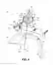 Fig. 05 - Medical device implantation and positioning system